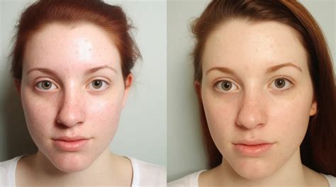 kan man ha finnar på tungan